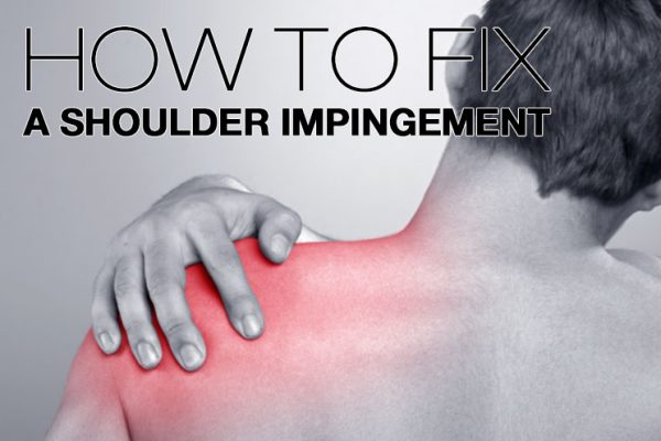 Shoulder Impingement: Symptoms, Causes, Treatment By Shoulder Braces