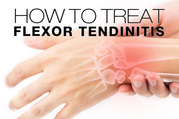 Tendinitis Flexora: Síntomas, Causas, Tratamiento Por Frenos para ...