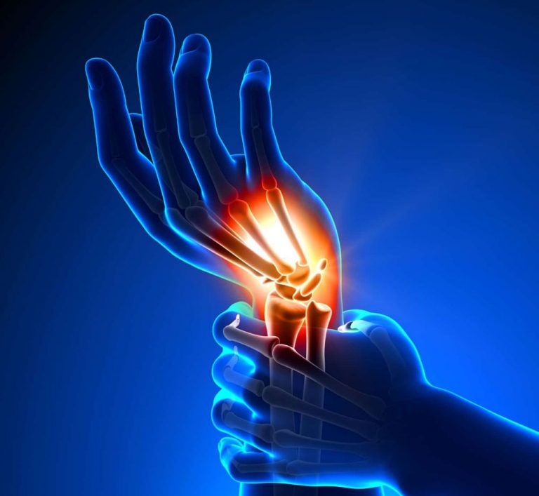 What Is Wrist Sprain Here Are Its Symptoms Causes Tre 2679